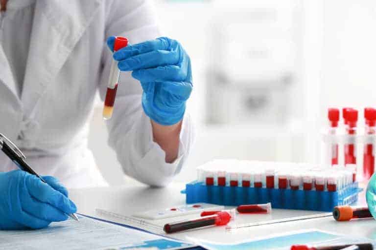 Pernicious anemia diagnosis how to test pa relief