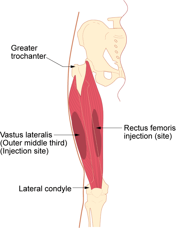 Thigh B12 injection site