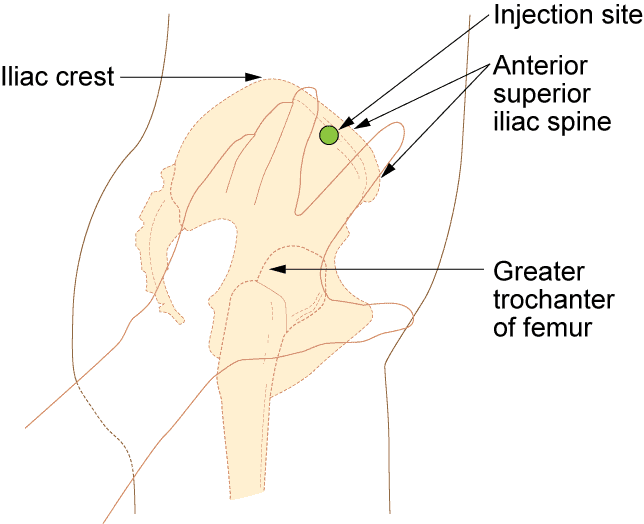 Ventrogluteal injection site