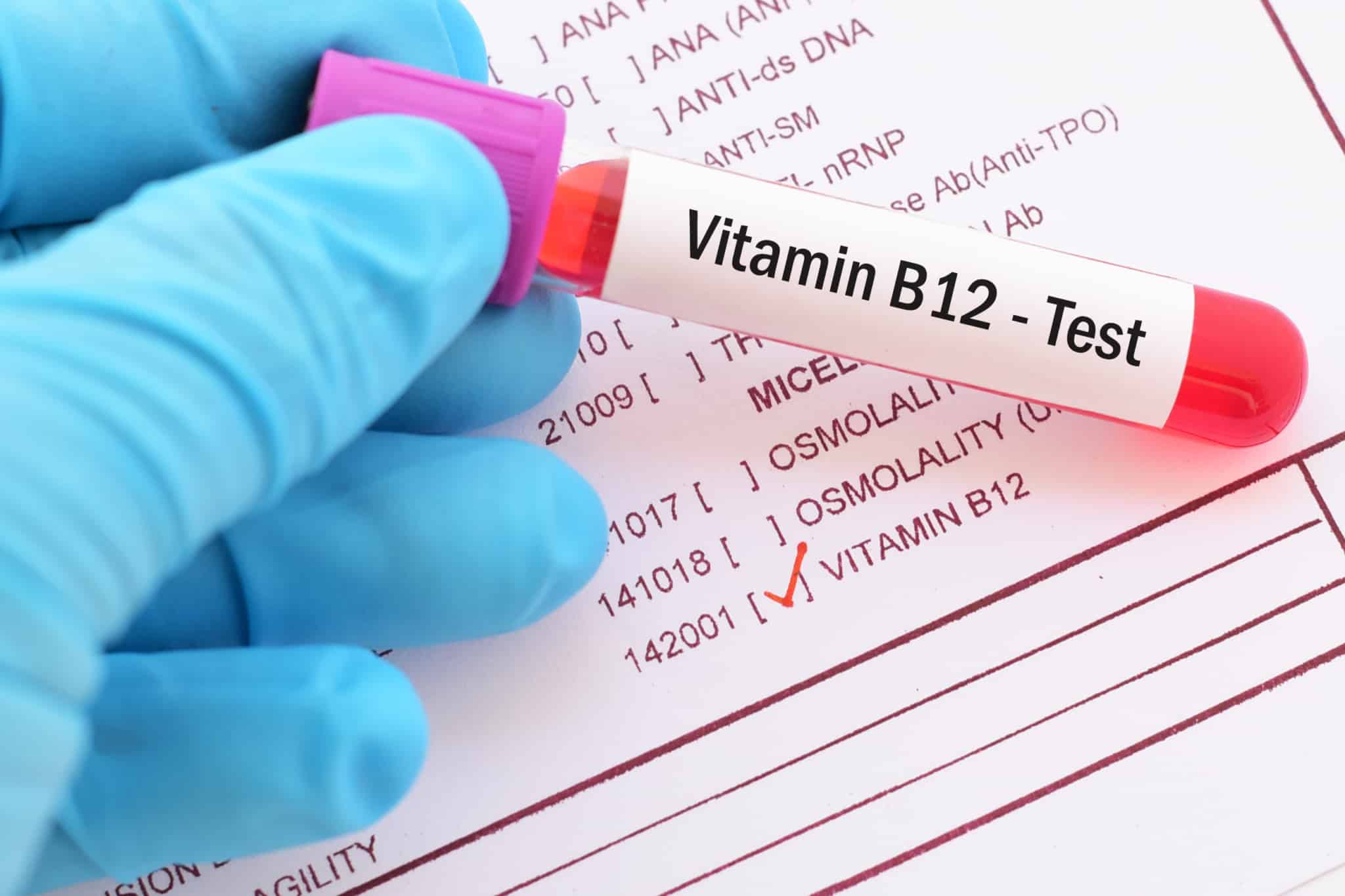 Normal B12 Levels By Age Vs Optimal Range PA Relief